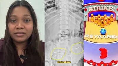 'Most terrifying 48 hours of my life': 3-year-old swallows 2 metal pins hidden inside birthday cake near Mumbai