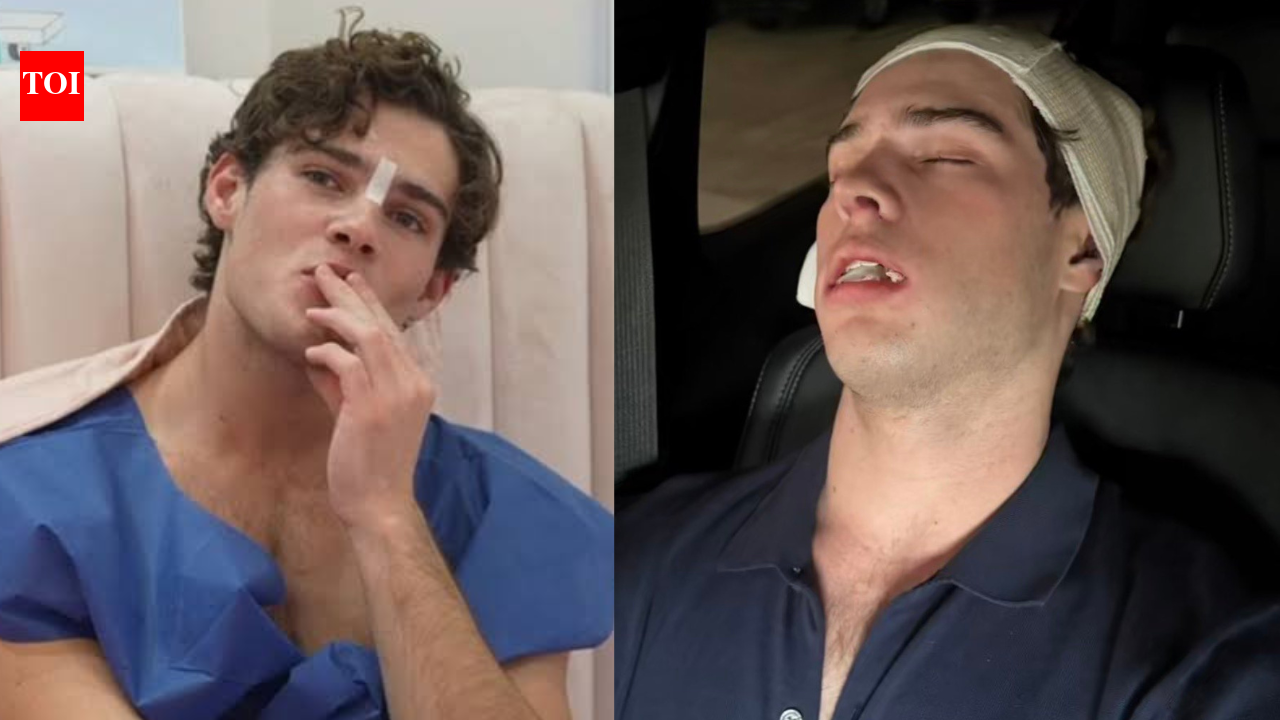 How many surgeries has streamer Clavicular completed ahead of Paris Fashion Week? His Ascension Week shocks fans