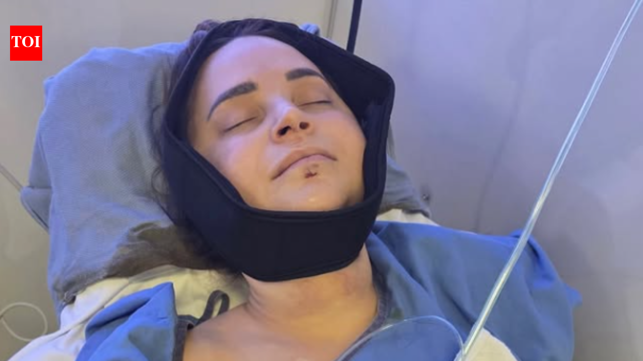 YouTuber Rosanna Pansino undergoes surgery after breaking jaw in boat accident