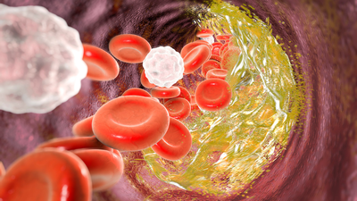  Why screening for inherited blood disorders before pregnancy matters