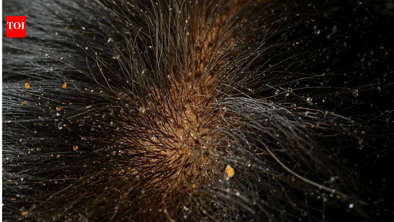 Here's what most people don't know about dandruff and scalp health