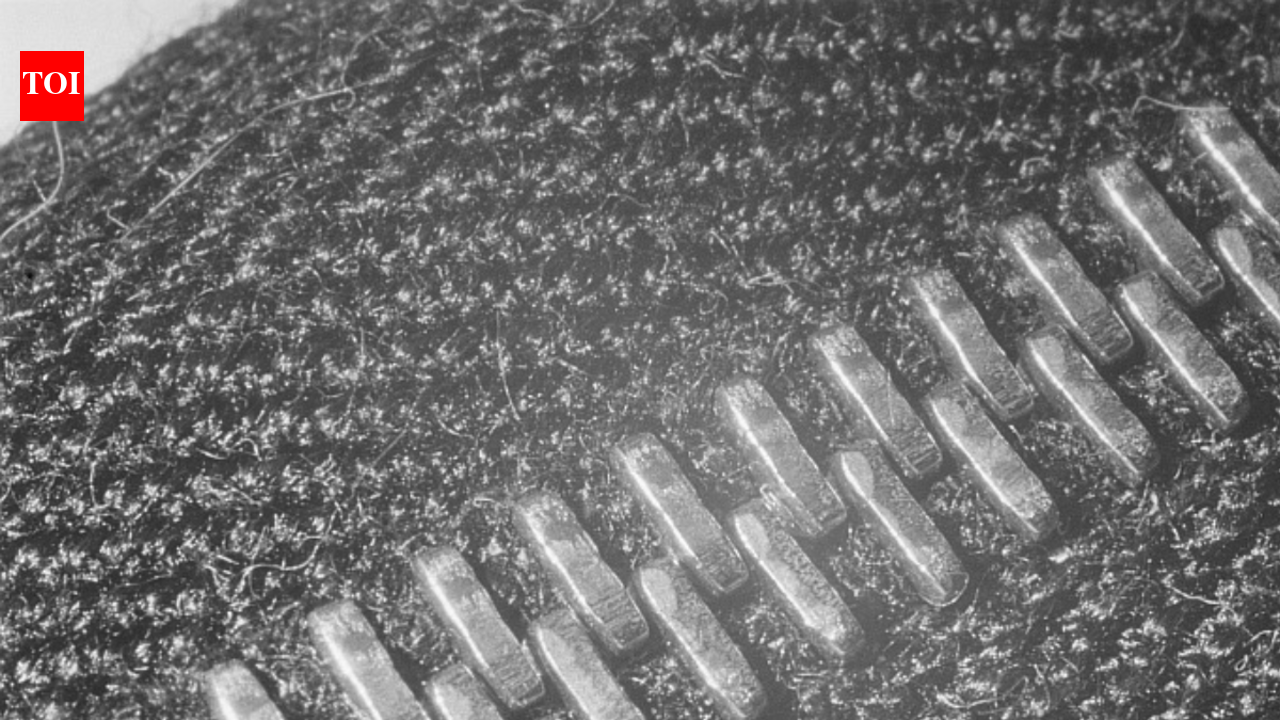 In 1913, Gideon Sundback redesigned a jam-prone fastener and gave the zipper its modern form