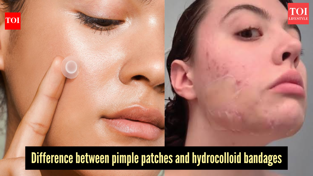 Pimple patches vs hydrocolloid bandages: Which acne treatment works best?