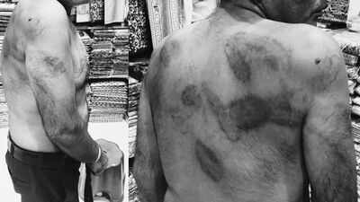 'They beat me as if I was a terrorist': Delhi man claims hours of torture inside police station