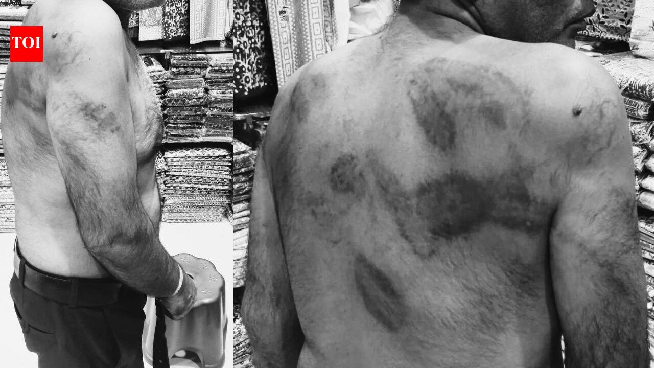 'They beat me as if I was a terrorist': Delhi man claims hours of torture inside police station