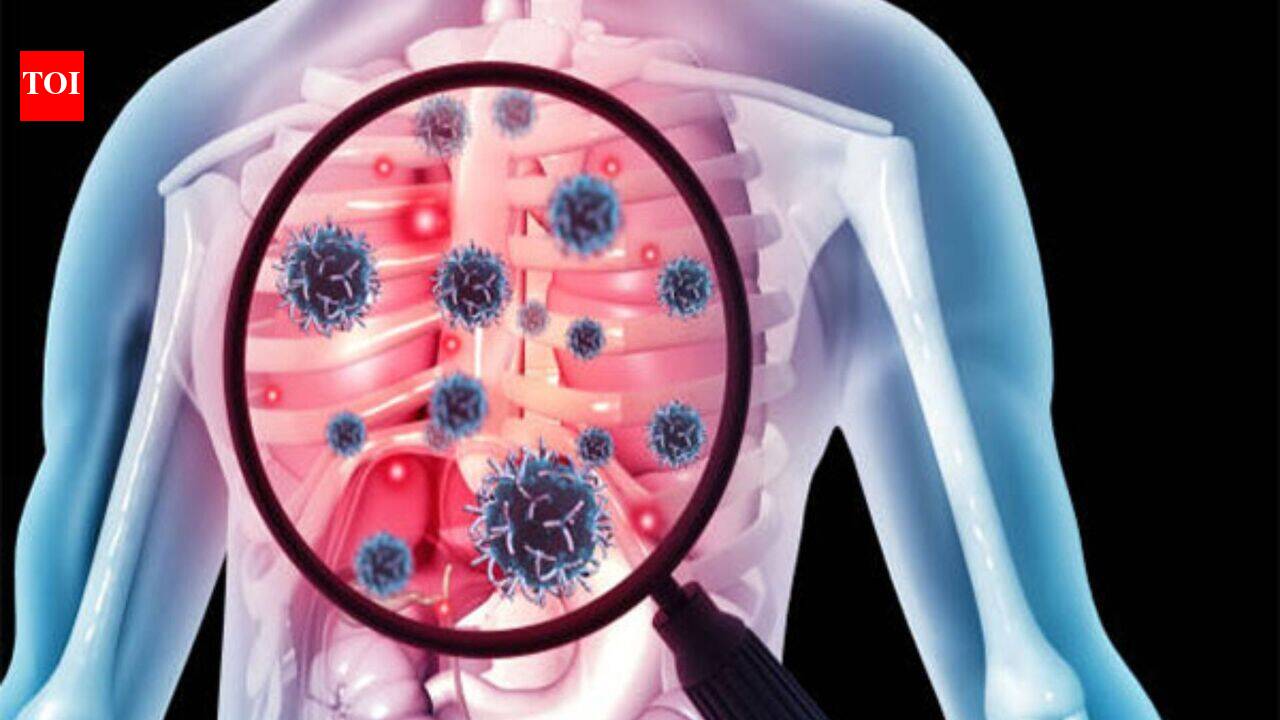 New tool can predict TB death risk at diagnosis, says study