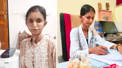 “My classmates and seniors gave me strange looks because of my appearance,": How this woman who is fighting a rare health condition became a doctor