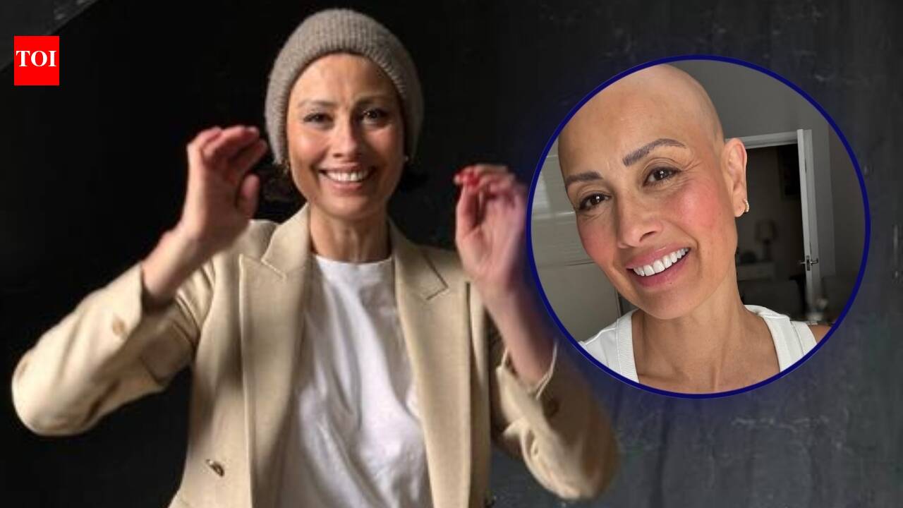 Melanie Sykes reveals her bald look, following the diagnosis of Alopecia: 'Loss + Gain = Life'