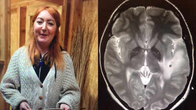  Lowri Denman shares story of her battle with neurocysticercosis