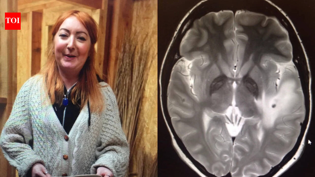 UK woman’s trip to India left her with ‘38 parasites in brain’: Lowri Denman shares story of her battle w - The Times of India