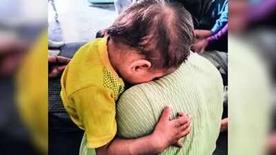 Nasal drop put into eyes, child loses vision in MP; probe blames malnutrition