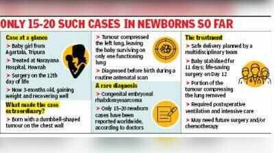 3-month-old back home after surgery to remove cancerous tumour