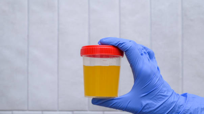 What your urine can—and can't—tell you about kidney health