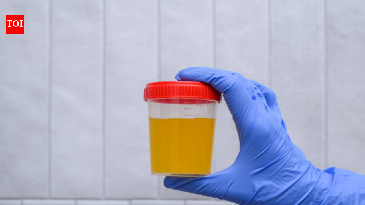 What your urine can—and can't—tell you about kidney health