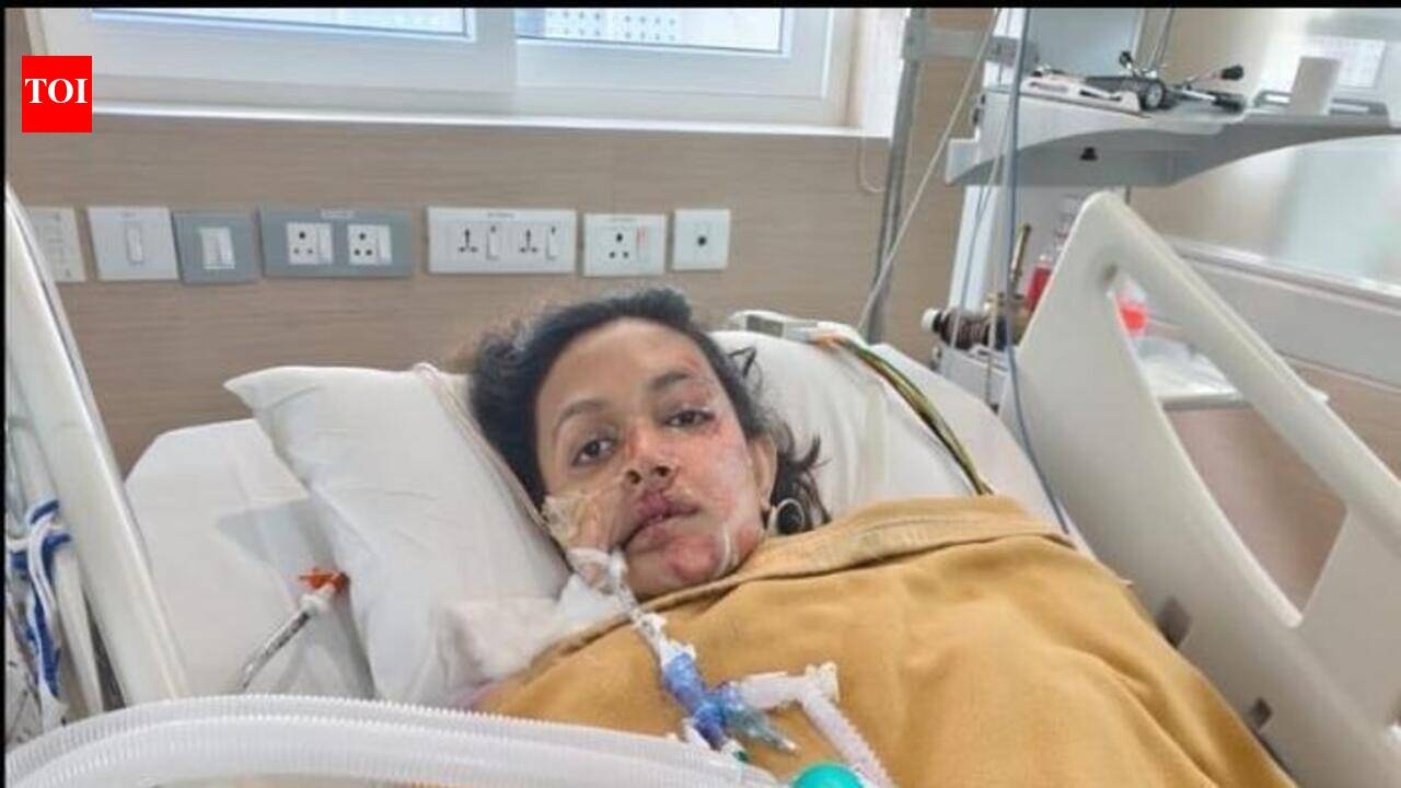 ‘No support from aggregator,’ says Kerala woman left bedridden after bike-taxi accident in Bengaluru