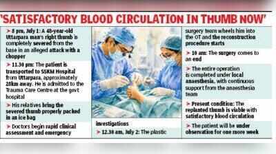 3.5 hours later, right thumb, severed in chopper attack, reaches SSKM 28 km away, replanted on Uttarpara man in a 10-hour surgery