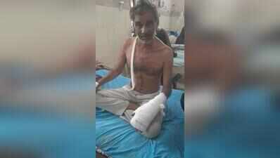  Lion attack survivor