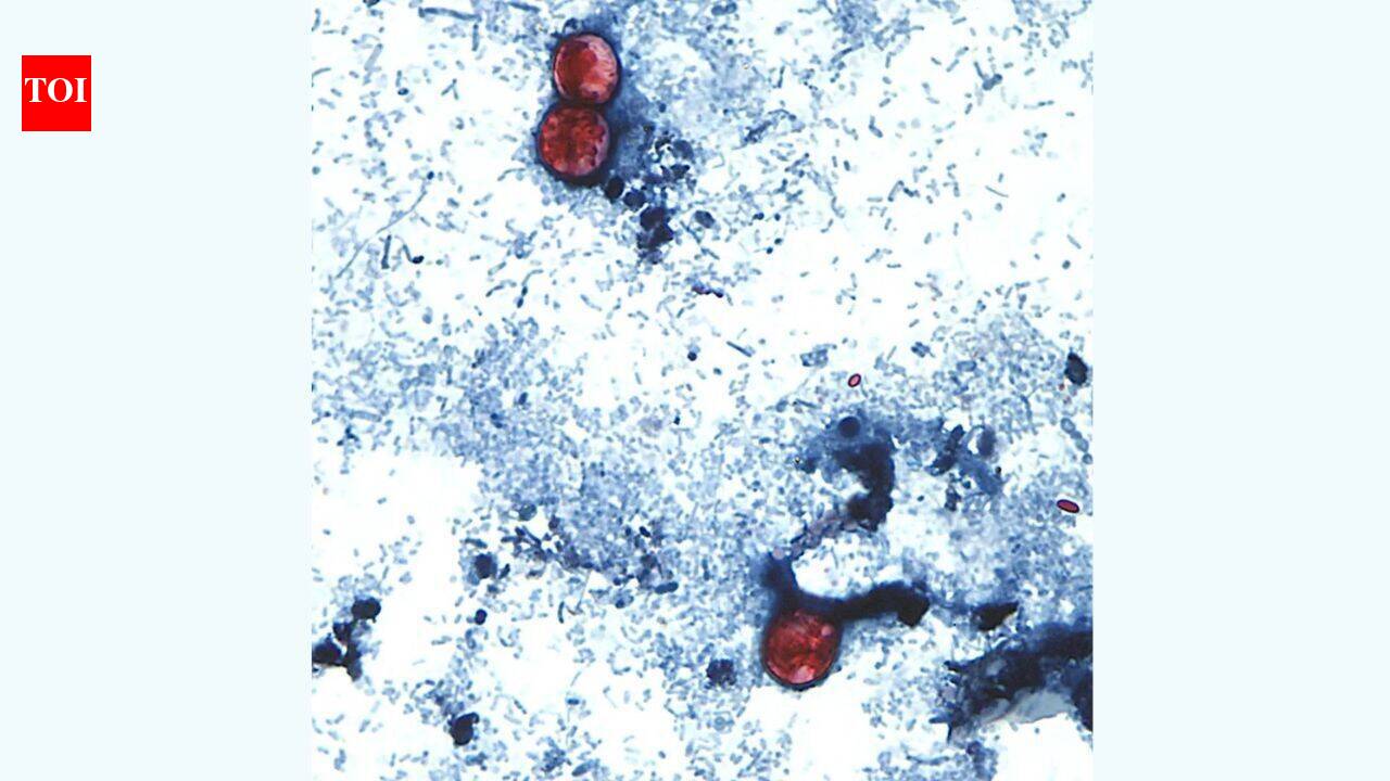 Nearly 1,000 cyclospora cases reported in Michigan in largest-ever parasite outbreak
