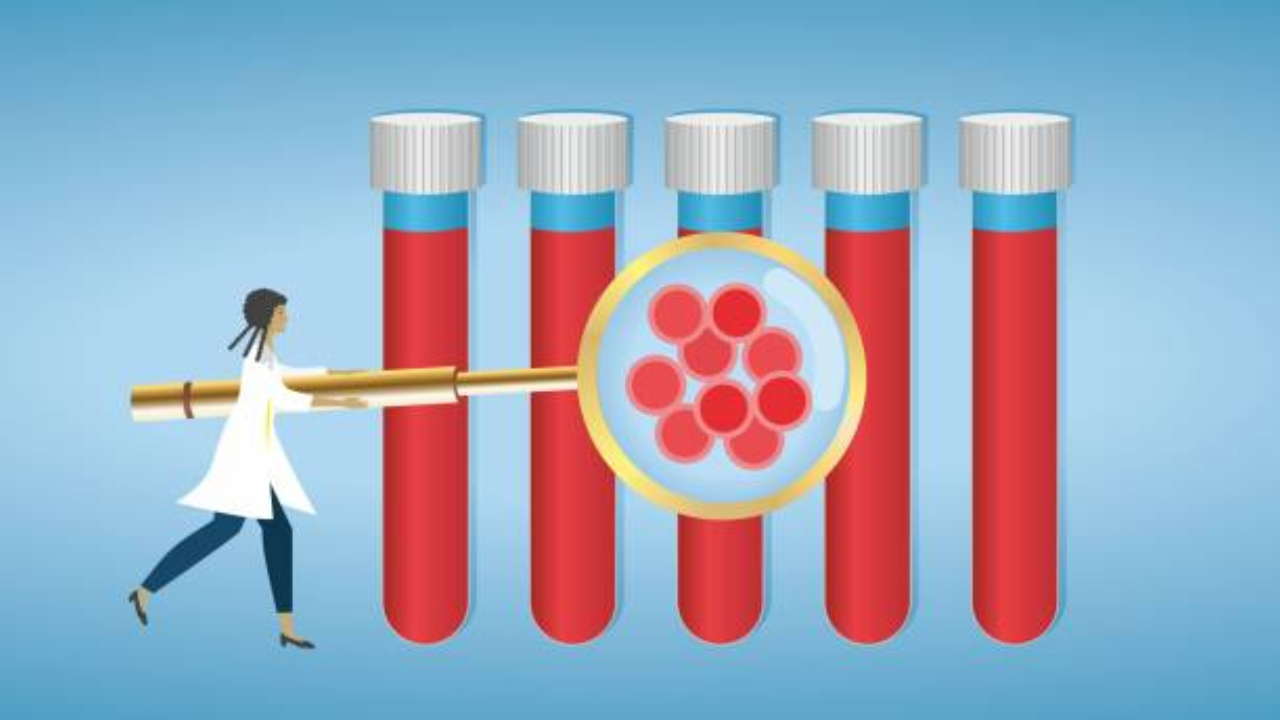 Sickle cell disease: Premarital and prenatal screening matters more than you think
