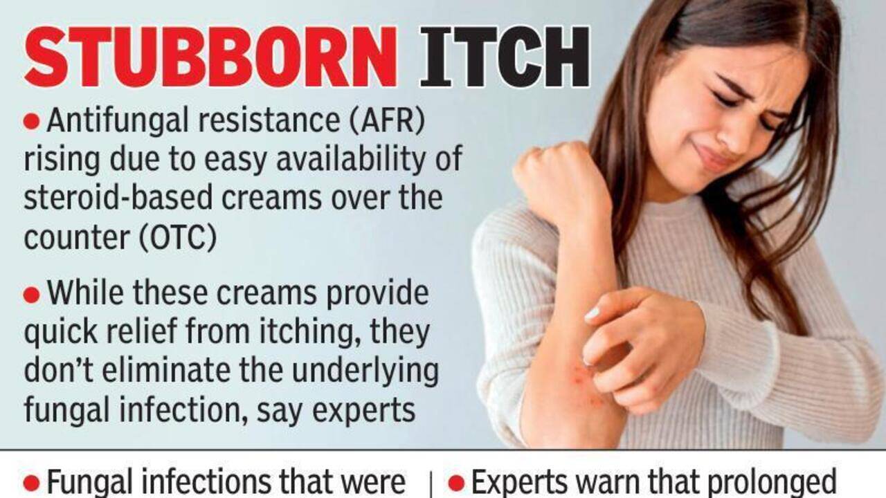 Steroid cream misuse fuels spurt in fungal infections