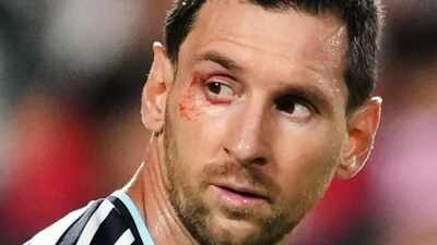 No easy wins in FIFA World Cup: Lionel Scaloni says 'suffering part of our DNA' as Argentina survive Switzerland scare