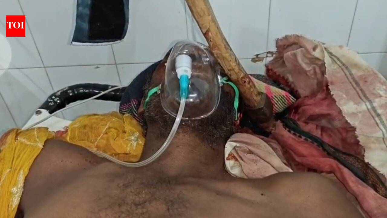 Doctors remove axe lodged in man’s skull