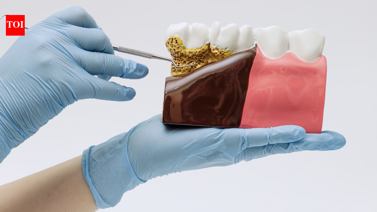 Bleeding gums may be doing more than harming your teeth: Scientists discover a link between gum disease bacteria and a serious heart valve condition