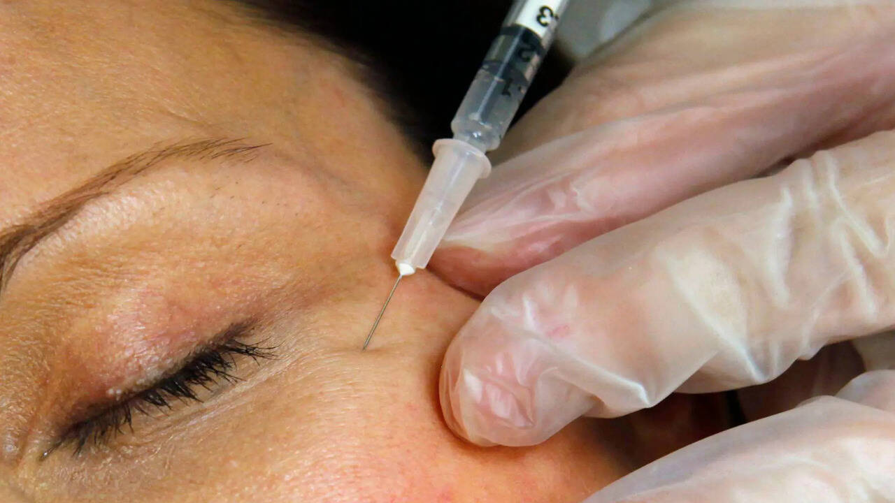 Zombie filler: Dead people’s fat is the latest beauty trend