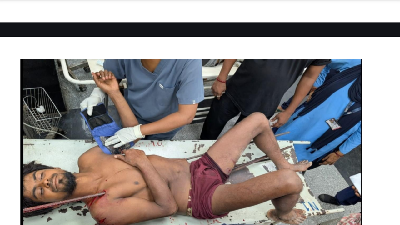 Labourer survives after falling onto rebar; KGMU removes four rods in 8.5-hour surgery