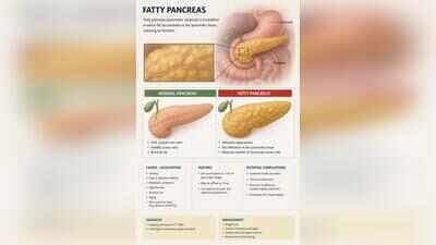 Fatty pancreas now a disease linked to diabetes and cancer