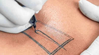 Contaminated needle? Kanpur woman tests HIV+ weeks after tattoo in Delhi