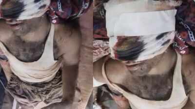 'Improper intentions toward my wife': Rajasthan man's nose, ear severed over family dispute; 2 detained