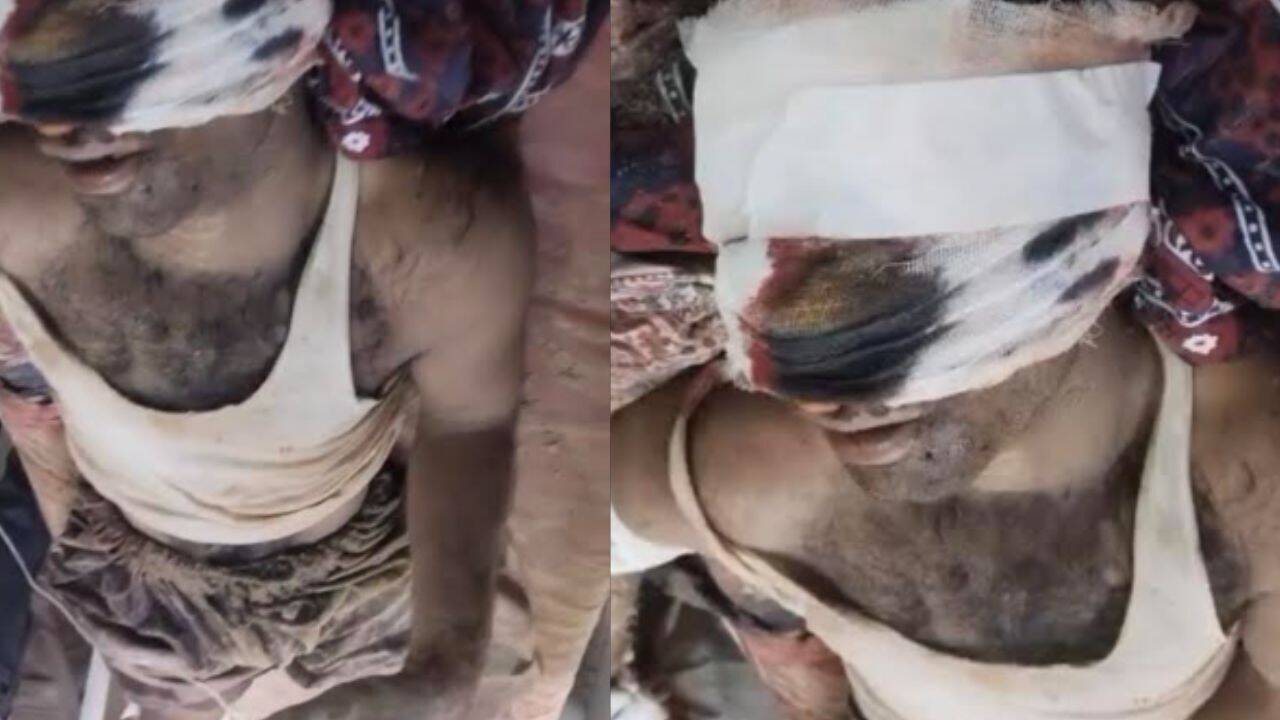 'Improper intentions toward my wife': Rajasthan man's nose, ear severed over family dispute; 2 detained