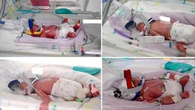 Australian woman gives birth to rare identical quadruplet girls after naturally conceived pregnancy