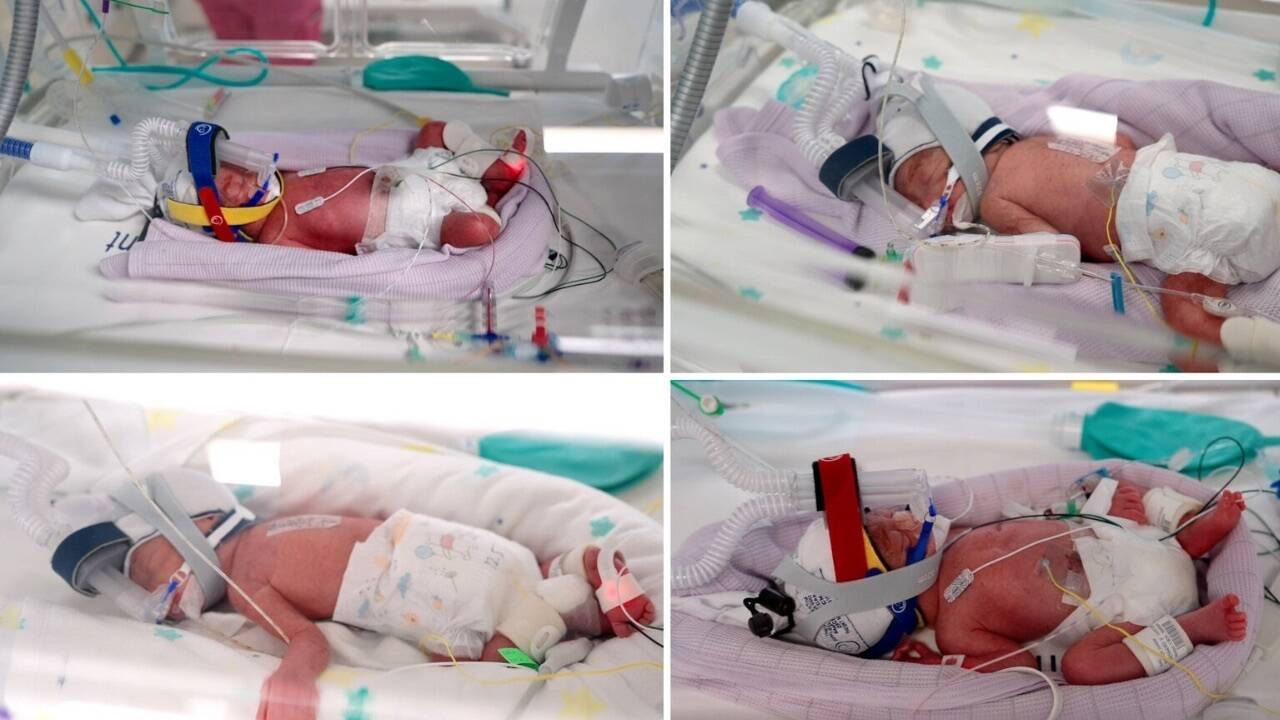 Australian woman gives birth to rare identical quadruplet girls after naturally conceived pregnancy
