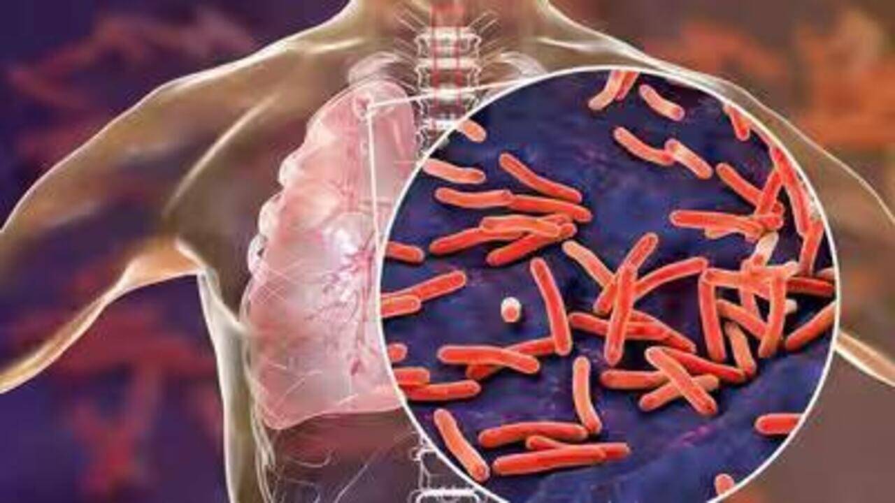 Over 8k TB cases detected in statewide screening drive