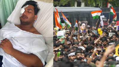 'Pitch black': Teen CJP protester battles for vision after pellet injuries; Delhi Police deny use of such weapons