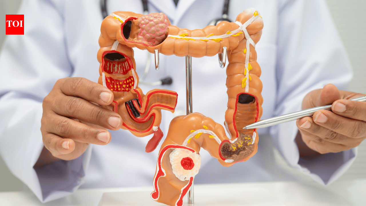 76-year-old woman diagnosed with rare small intestine cancer undergoes complex surgery involving the bowel, colon and liver