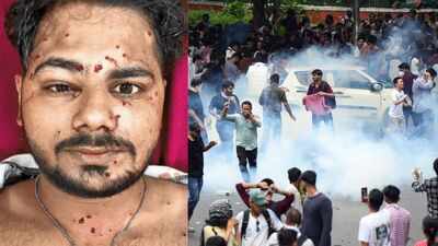 ‘I thought he was only trying to scare me’: CJP protester recalls being shot in face by pellet gun