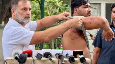 'His eye suffered damage': Rahul Gandhi brings alleged pellet gun victim before media, renews call to sack Pradhan
