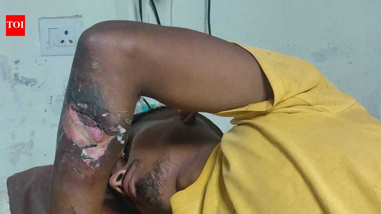 VTR forest guard injured by live electric wire laid for poaching