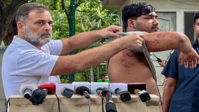 'Who approved pellet guns?' Rahul Gandhi writes Amit Shah over 'barbaric assault' on students