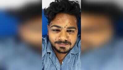 ‘Scars remain, but no regrets’, says protester injured by pellet gun