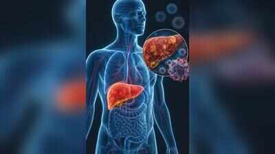 Goa sees 504 hepatitis B&C cases in 2025–26, raises alarm on alcohol risks