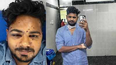 ‘Scars remain, but no regrets’: Jantar Mantar protester hit by pellet gun