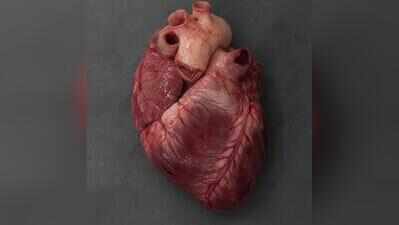 Chennai teen with mesocardia and Morquio syndrome undergoes complex heart surgery