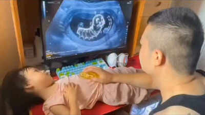 Father tricks daughter with fake ultrasound to stop her from eating junk food; why ultra-processed foods are hard to resist and how parents can promote healthy eating habits