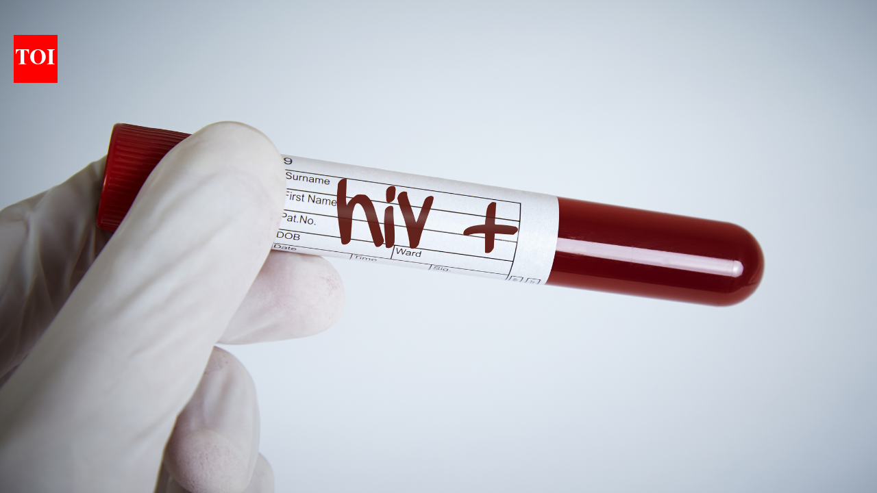 Millions still get this wrong about HIV: Doctor explains exactly how the virus spreads, and how it doesn't - The Times of India