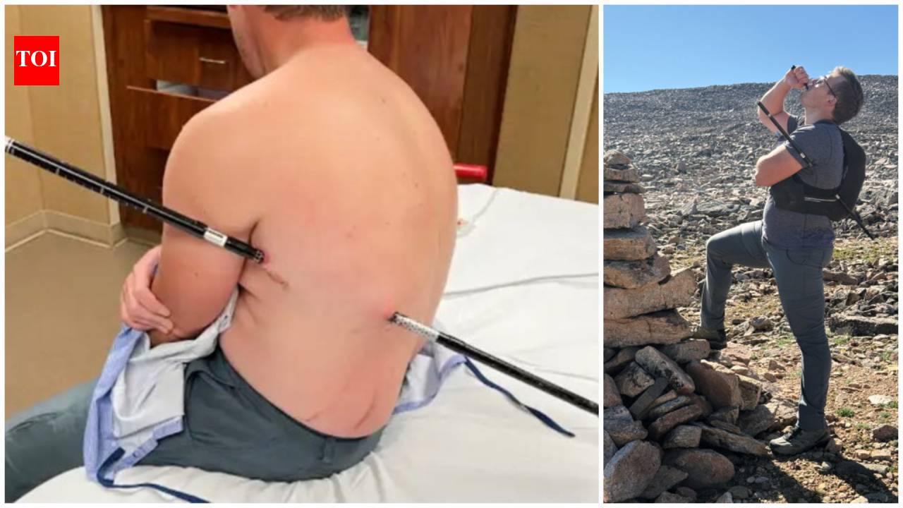 Montana man impales himself on trekking pole, hikes 10 miles to safety instead of calling helicopter