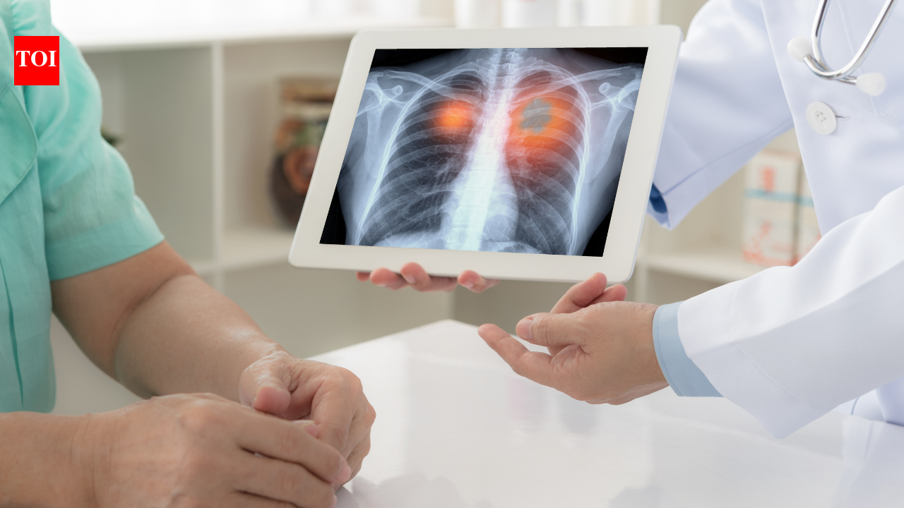 The three words that terrify every family: Why 'stage 4 lung cancer' is no longer the death sentence many people believe it is